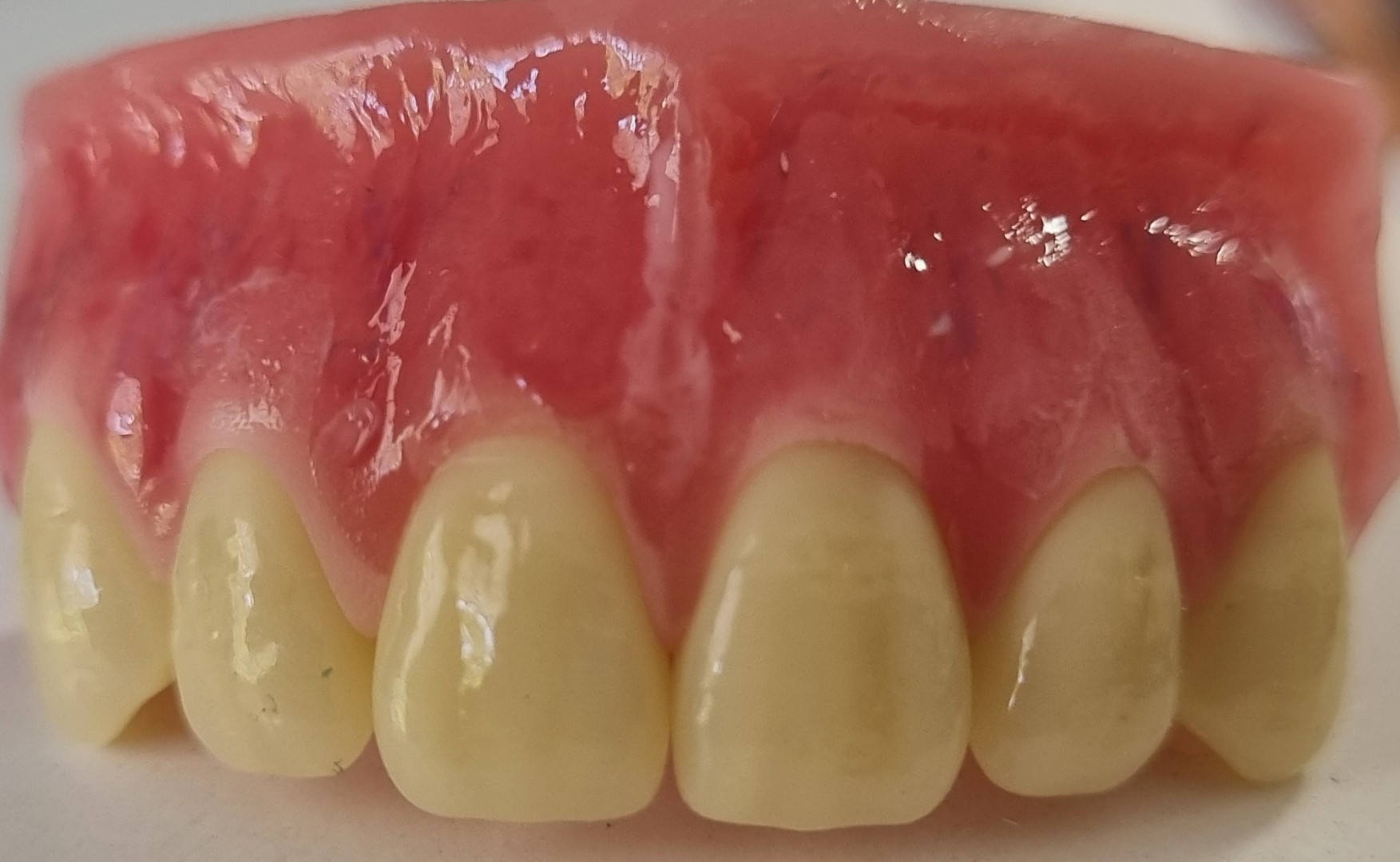 Precision denture work at CAV Denture Clinic